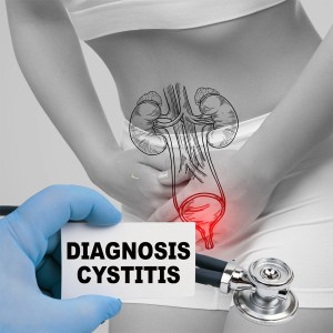 Nessuna immagine impostata 